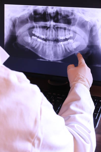 Best Emergency Root Canal Therapy in Shively, KY