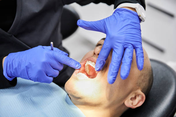 Best Emergency Dental Care for Sports Injuries in Shively, KY