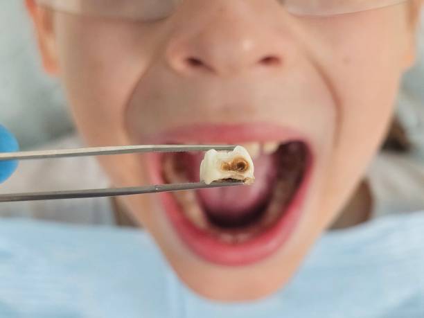 Best Emergency Cosmetic Dentistry (e.g., broken veneers) in Shively, KY